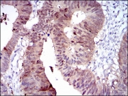 AM06716PU-N - CYP1A1