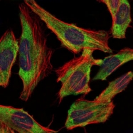 AM06717PU-N - Neurofilament L (68kDa)