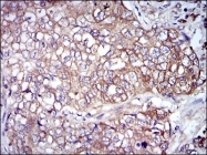 AM06717PU-N - Neurofilament L (68kDa)