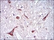 AM06717PU-N - Neurofilament L (68kDa)