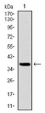 AM06731PU-N - FOXO1A