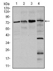 AM06731PU-N - FOXO1A