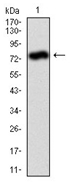 AM06737PU-N - Alkaline phosphatase / ALPL