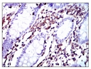 AM06738PU-N - Moesin