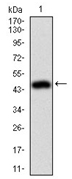 AM06738PU-N - Moesin