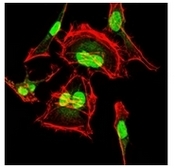 AM06741PU-N - CDK2