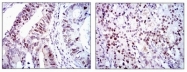 AM06741PU-N - CDK2