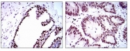 AM06744PU-N - RPA1