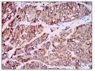 AM06749PU-N - MCP1 / CCL2
