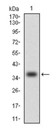 AM06749PU-N - MCP1 / CCL2
