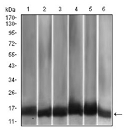 AM06749PU-N - MCP1 / CCL2