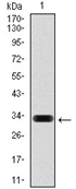 AM06752PU-N - Hyaluronic acid synthase 3 / HAS3