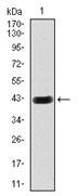 AM06756PU-N - Beta-hexosaminidase alpha / HEXA