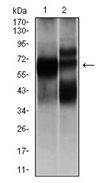 AM06756PU-N - Beta-hexosaminidase alpha / HEXA