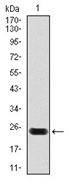 AM06763SU-N - Cardiac Troponin T
