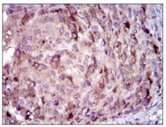 AM06764SU-N - C-reactive protein (CRP)