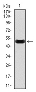 AM06764SU-N - C-reactive protein (CRP)