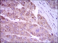 AM06772PU-N - NOS2