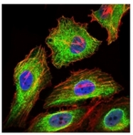 AM06776PU-N - Glypican-3 / GPC3