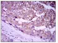 AM06776PU-N - Glypican-3 / GPC3