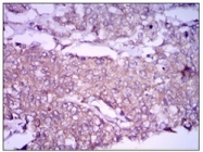 AM06776PU-N - Glypican-3 / GPC3