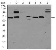 AM06776PU-N - Glypican-3 / GPC3