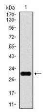 AM06776PU-N - Glypican-3 / GPC3