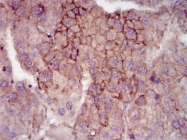 AM06778PU-N - MELK
