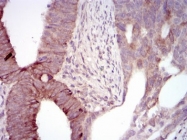 AM06778PU-N - MELK