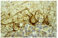 AM08251SU-N - Neurofilament H (200 kD)