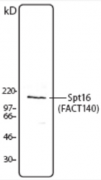 AM08331PU-M - SUPT16H / FACT140