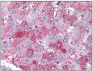 AM08331PU-M - SUPT16H / FACT140