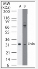 AM08363PU-N - BIRC7 / LIVIN