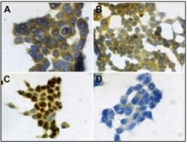 AM08370PU-N - S100A7 / Psoriasin