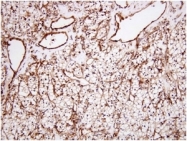 AM09004PU-N - Apolipoprotein J / Apo J