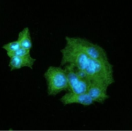AM09005PU-N - C-reactive protein (CRP)