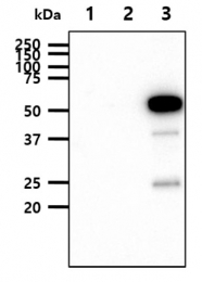 AM09008PU-N - EPHA2 / ECK