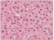 AM09011PU-N - FABP1