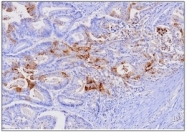 AM09011PU-N - FABP1