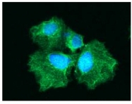 AM09014PU-N - Hexokinase-3