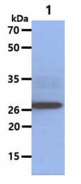 AM09043PU-N - 14-3-3 protein beta/alpha