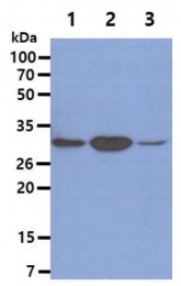 AM09046PU-N - TOLLIP