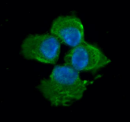 AM09080PU-N - Myosin light chain 2 (MYL2)