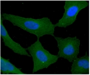 AM09087PU-N - Tomoregulin-2 / TMEFF2
