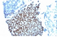 AM09100PU-T - CDKN1A / p21WAF1