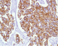 AM09115PU-N - Cytokeratin 18