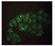 AM09264PU-N - Beta-2-microglobulin