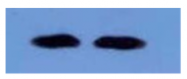 AM09265PU-N - Beta-2-microglobulin