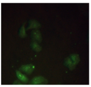AM09265PU-N - Beta-2-microglobulin