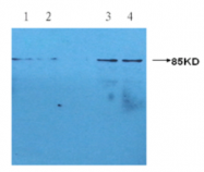 AM09268PU-N - C-reactive protein (CRP)